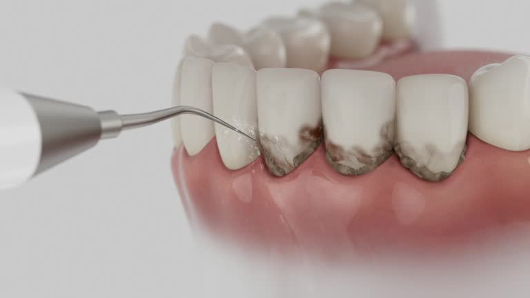 Reliable Teeth Cleaning And Checkup contractor in Holmes County County, MS by Dentist Open Now